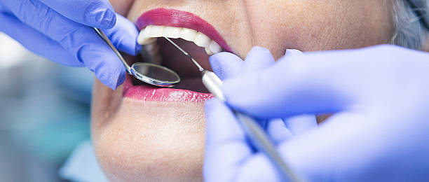 Best Knocked-Out Tooth (Avulsed Tooth) Treatment in Zuni Pueblo, NM